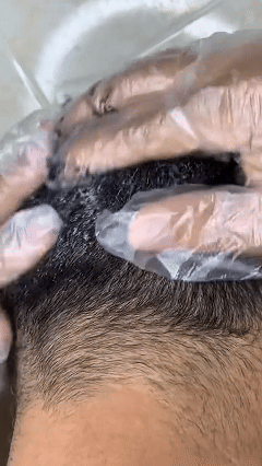 SHAMPOO NATUREL-NEGRO-ANTICANAS